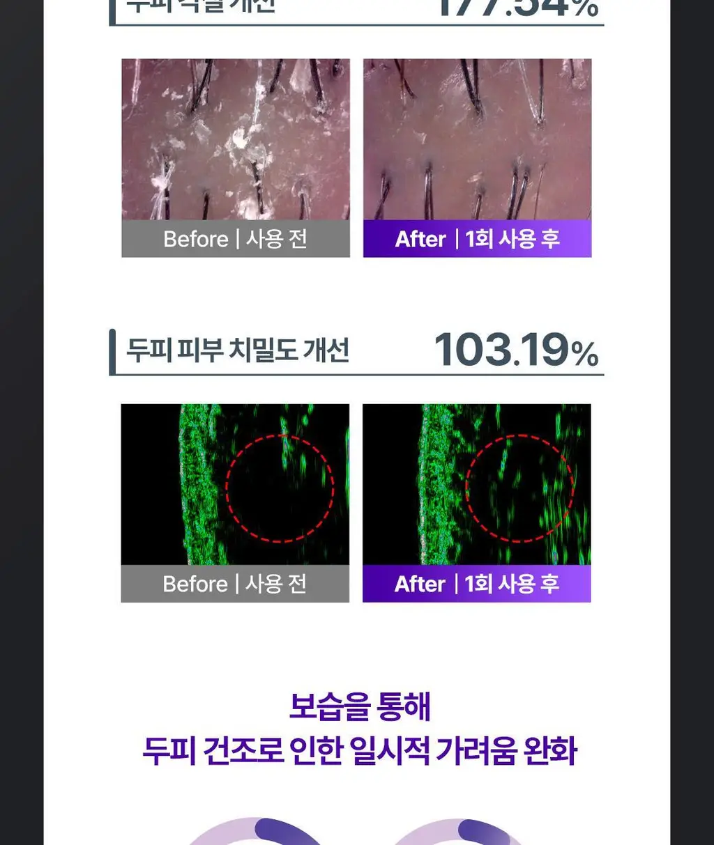 [No.1 헤어/두피 디바이스] 레스노베 하이퍼샷(베이지/핑크) 상세페이지 22